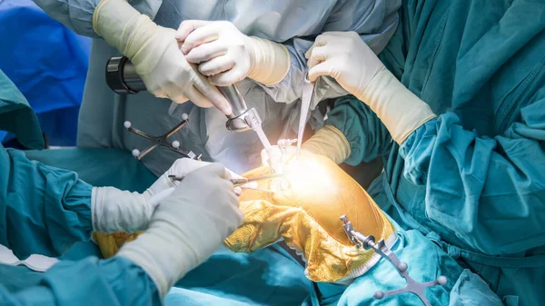 Médico Cirujano Bata Azul Utiliza Navegador Robótico Artroplastia Total Rodilla — Foto de Stock