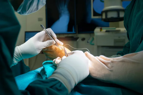 医者や外科医の手は病院の手術室内で足の手術をしました 緑のガウンの人々は外科的傷を縫合するために医療ツールを使用しました — ストック写真