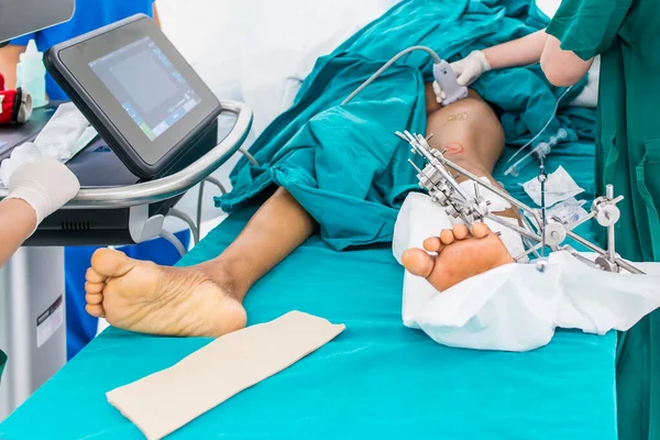 外固定器装置在创伤或骨折患者中应用于整形外科 麻醉师在超声引导下做了局部股神经阻滞 在麻醉单元用计算机进行无痛手术 — 图库照片