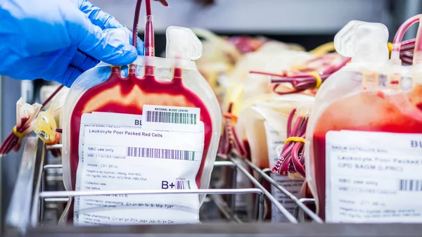 Leukocyte 적혈구 트레이에 Label Rare 입원중 환자의 헌혈이나 치료를 준비하는 — 스톡 사진