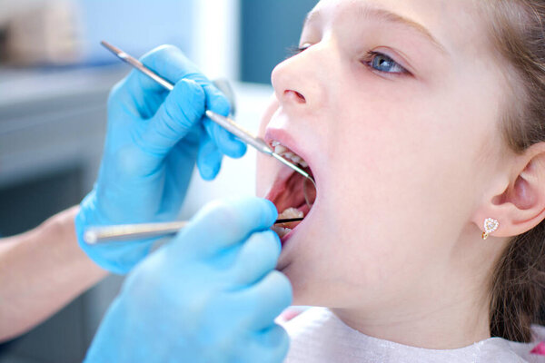 Крупный план молодой девушки с открытым ртом, у которой зубы осматривает дантист