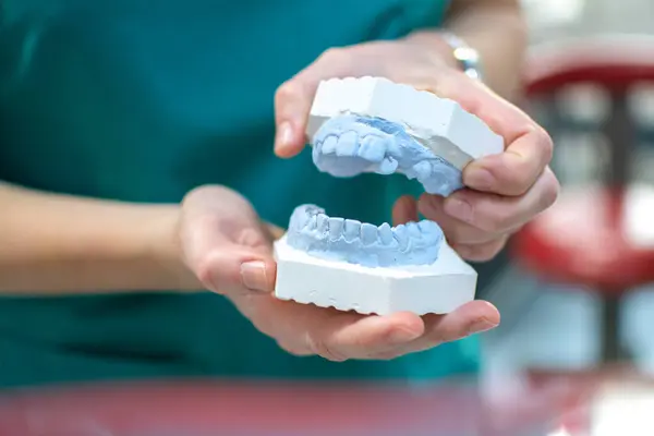 Closeup Dentists Hands Holding Model Human Jaw Dental Office — Stock Photo, Image
