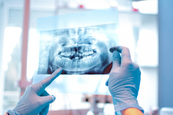 Female dentist holding a dental X-Ray. 