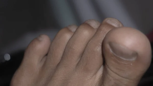 Toes of a person. feet of a human.