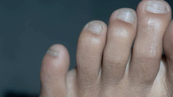 Toes of a person. feet of a human.