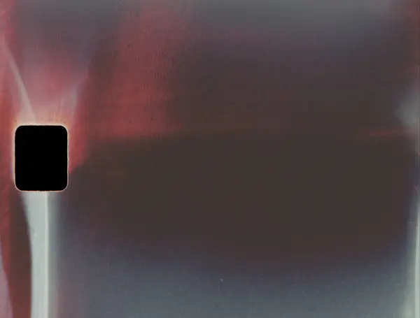 Yumuşak bir ışık sızıntısı ve sıcak film yanığı içeren gerçekçi film dokusu. Retro görsel projeler, kaplamalar ve klasik film estetiği için mükemmel. Klasik film çerçevesinde ışık sızıntısı olan film yanığı.