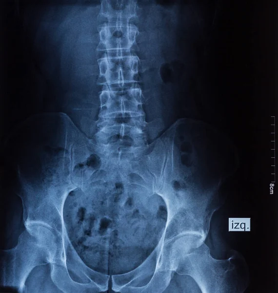 Spinal Column Waist Ray Backbone Radiography Medical Exam Anatomy Hospital — Stock Photo, Image