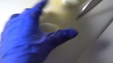 Diyet salatası hazırlamak için, haşlanmış yumurtaları bıçakla küçük parçalara ayır.