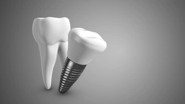 牙齿螺丝医疗技术背景 — 图库视频影像