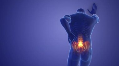 Pain in the back joint medical concept