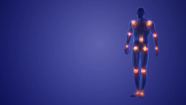 Human Body Joint Pain Medical Concept — Stock videók