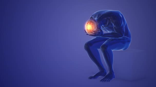 Human Having Severe Headache Pain Migraine Concept — Stock videók