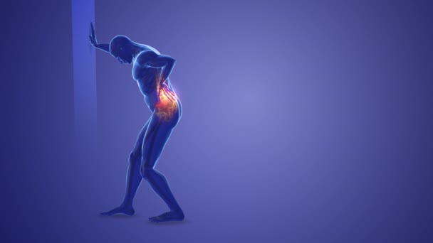 背中関節の痛み 医学的背景 — ストック動画