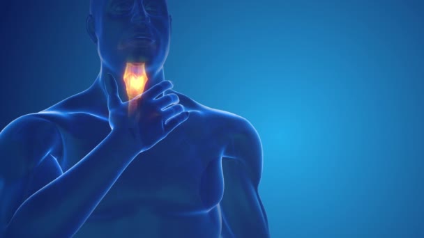 Human Medical Figure Sore Throat — Stockvideo