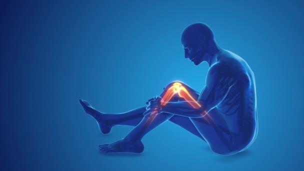 膝盖关节疼痛 — 图库视频影像