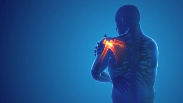 Pain Shoulder Joint — Video Stock