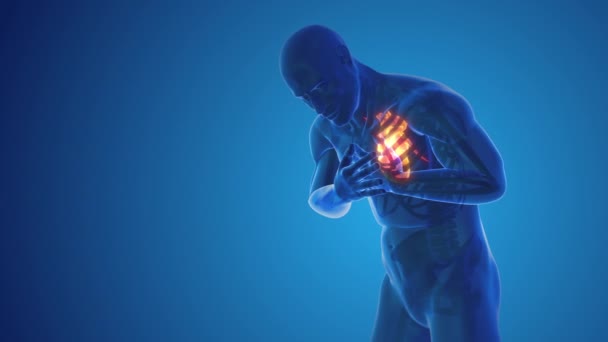 Біль Від Серцевого Нападу Грудях — стокове відео