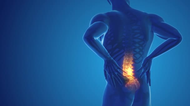 Schmerzen Rückengelenk — Stockvideo