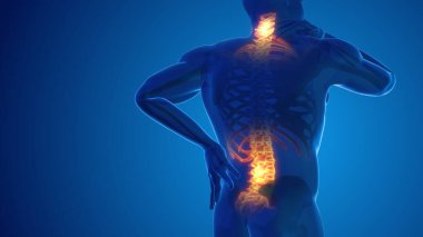 Pain in the back and neck joint clipart