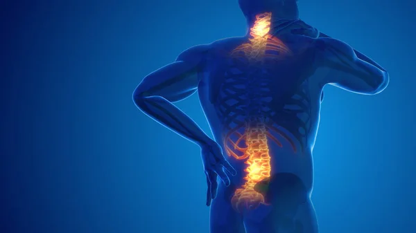 Pain in the back and neck joint