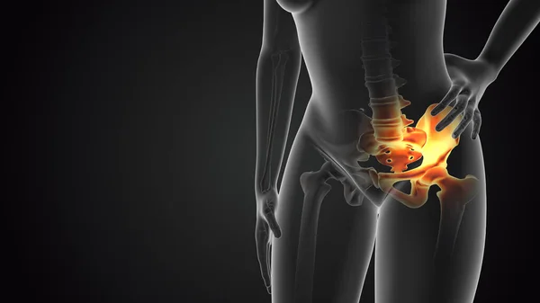 Pelvic joint pain medical concept