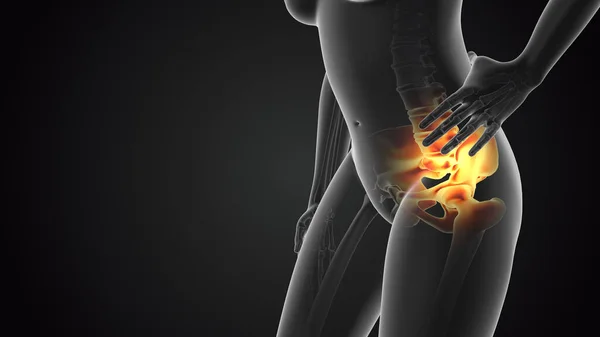 Pelvic joint pain medical concept