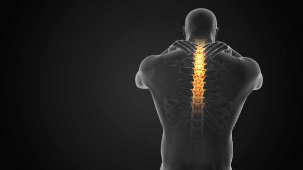 颈部关节和脊柱疼痛医学概念 — 图库视频影像