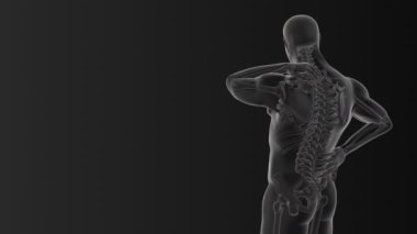 Servikal vertebral ağrı Tıbbi animasyon