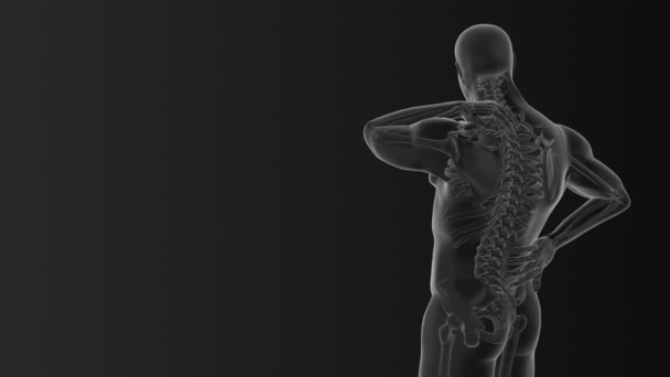 Livmoderhalscancer Smärta Medicinsk Animation — Stockvideo