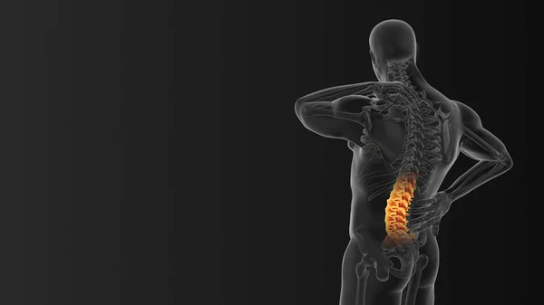 Cervical vertebral pain medical concept