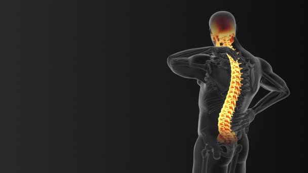 Neck Back Joint Pain Medical Concept — Stock Video
