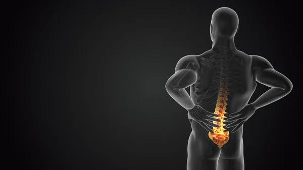 Lower back joint pain medical concept