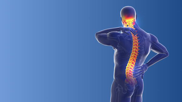 Медицинская концепция боли в шее и спине