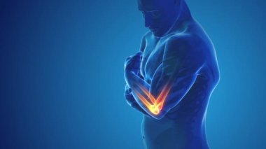 dirsek eklem ağrısı