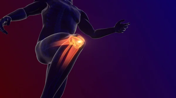 Pain Knee Joint — Stock Fotó