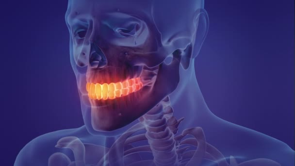 疼痛的牙齿的动画 — 图库视频影像