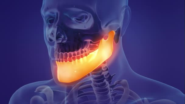 Animation Painful Mandible — Stock Video