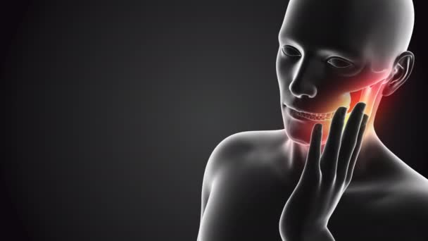 顎に痛みがある人間 — ストック動画