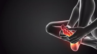 Ayakları ağrıyan insanlar.