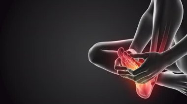 Ayakları ağrıyan insanlar.