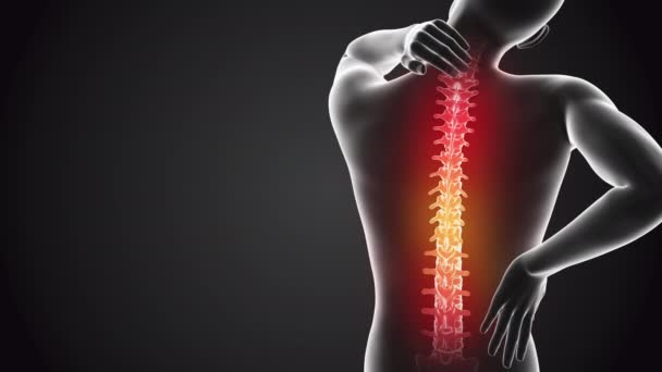 Der Mensch Hat Rückenschmerzen — Stockvideo