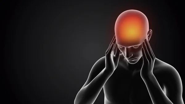 Manusia Memiliki Rasa Sakit Kepala — Stok Foto