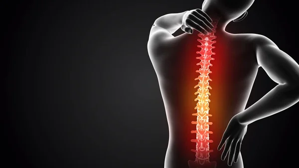 Der Mensch Hat Rückenschmerzen — Stockfoto