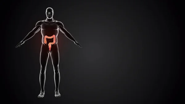 大腸を持つ人体 — ストック写真