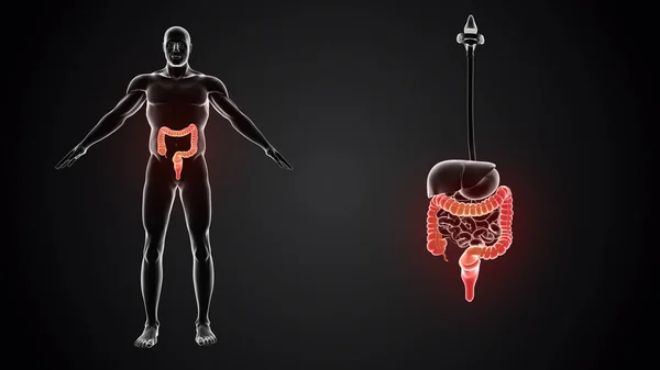 大腸を持つ人体 — ストック写真