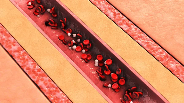 Menschliche Blutgefäße Schnitt Mit Roten Und Weißen Blutkörperchen — Stockfoto