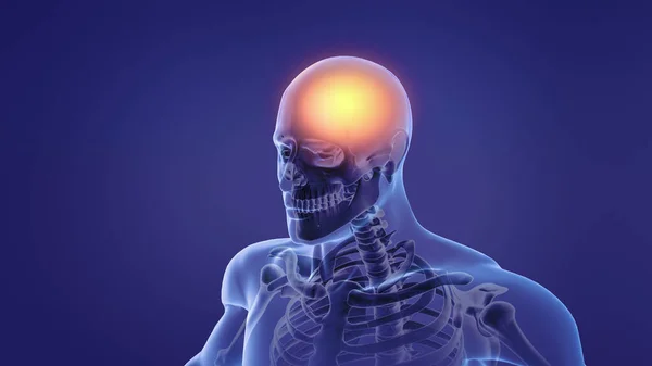 Pojęcie Mężczyzny Bólem Głowy — Zdjęcie stockowe
