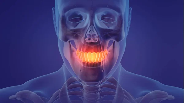 Animation of a painful teeth