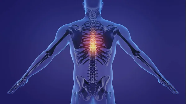 疼痛的人类脊椎的动画 — 图库照片