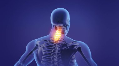 Animation of a painful neck clipart